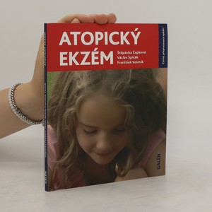 náhled knihy - Atopický ekzém