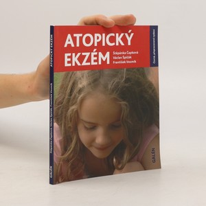 náhled knihy - Atopický ekzém